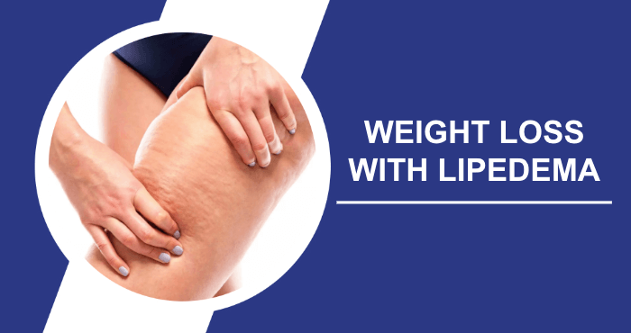 Effective Weight Loss With Lipedema