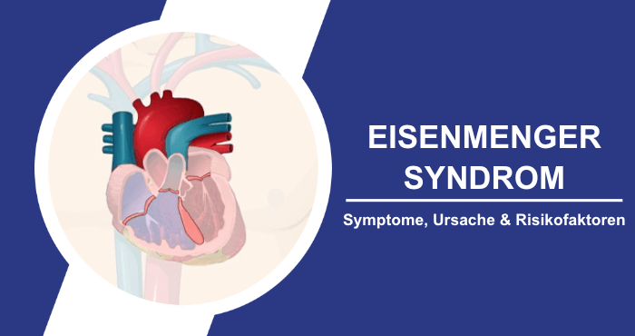 Alles Wissenswerte über das Eisenmenger-Syndrom Titelbild