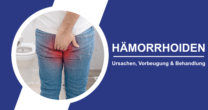 Haemorrhoiden Titelbild