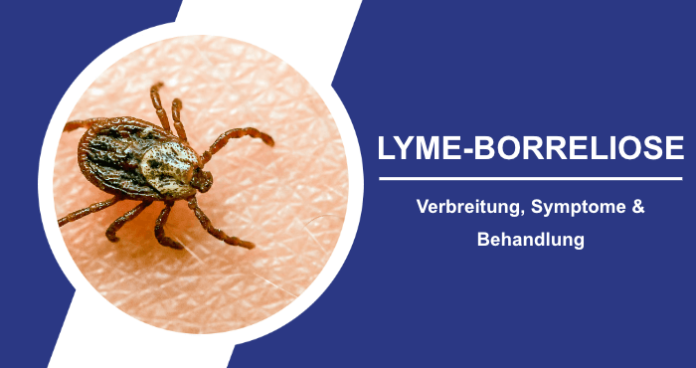 Verbreitung, Symptome und Behandlung der Lyme-Borreliose