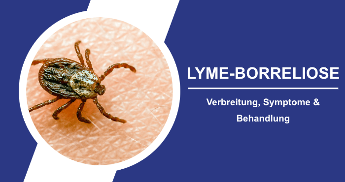 Verbreitung Symptome und Behandlung Lyme-Borreliose Titelbild