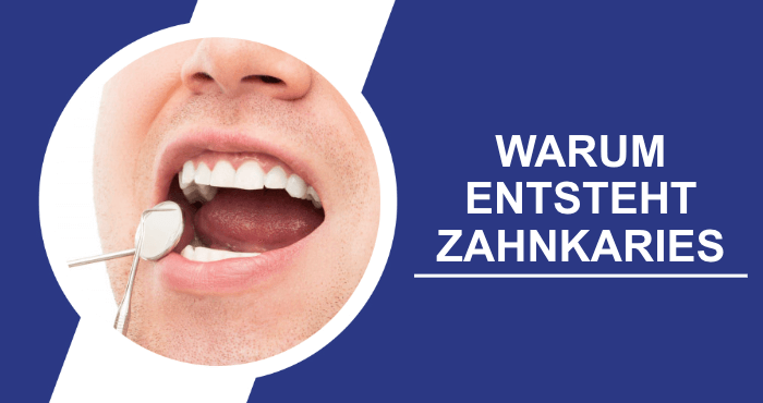 Warum entsteht Zahnkaries Titelbild